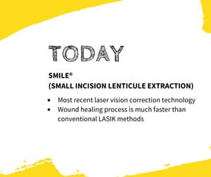 Today: SMILE (Small Incision Lenticule Extraction)