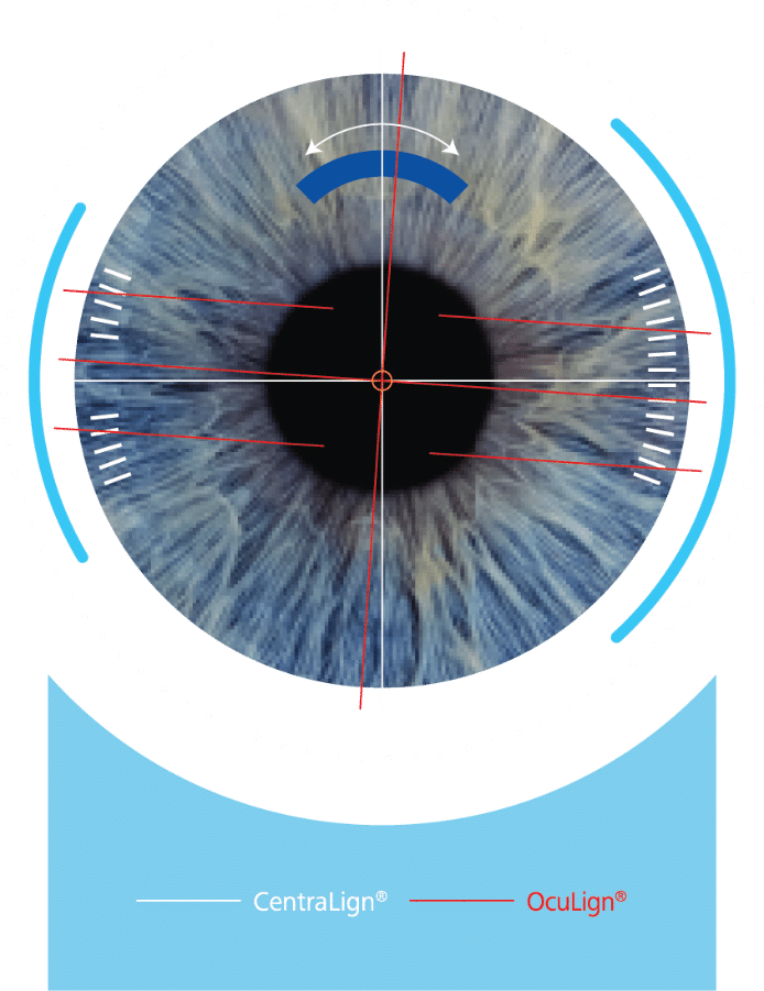 ZEISS SMILE pro 2.0